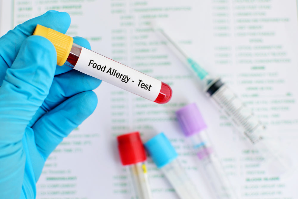Food Allergies Vs Food Intolerances + Their Testing Methods