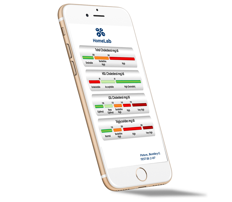 HomeLab TSH Thyroid Stimulating Hormone online results